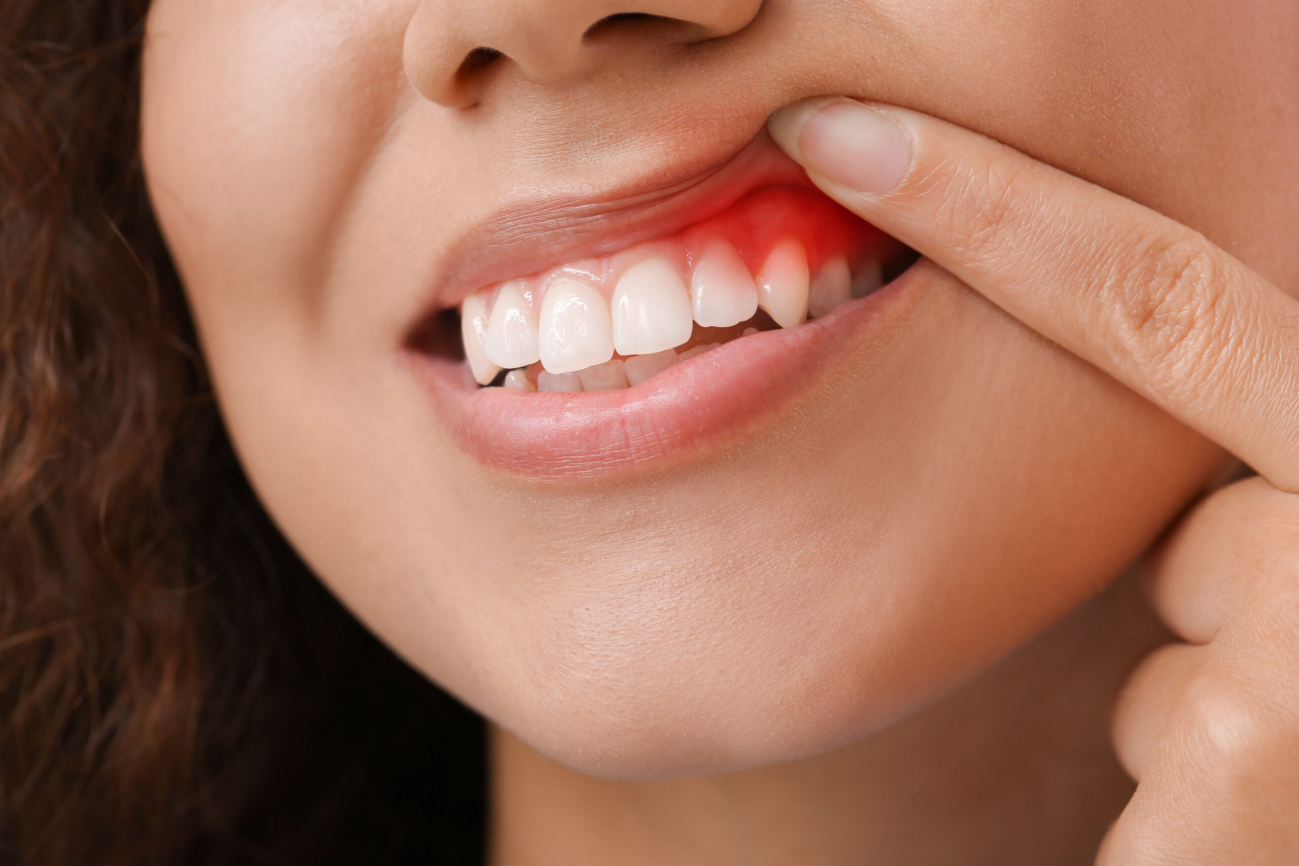 Leesburg Periodontal Gum Disease