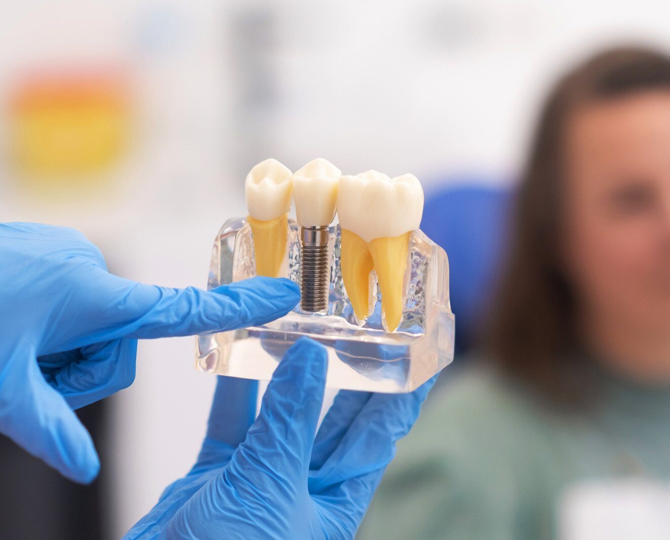 Leesburg Dental Implants